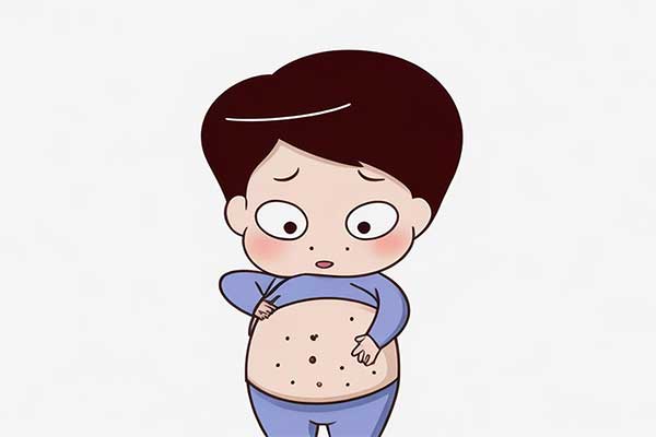 Ƥ����,����Ƥ����,����ʪ��,��м��,��״����